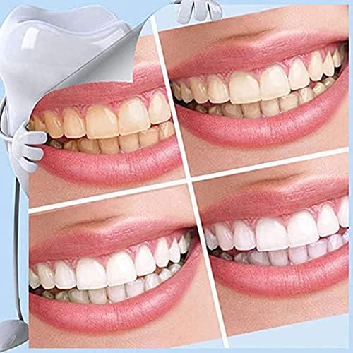 Kit de clareamento dos dentes, polimento dos dentes, removedor de manchas de dente, adequado para manchas de fumaça, dentes pretos, dentes amarelos