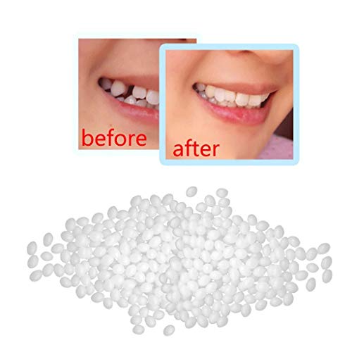 Dentes de plástico cola dentaduras de maquiagem modificadas de dentes de preenchimento temporário de dentes de preenchimento