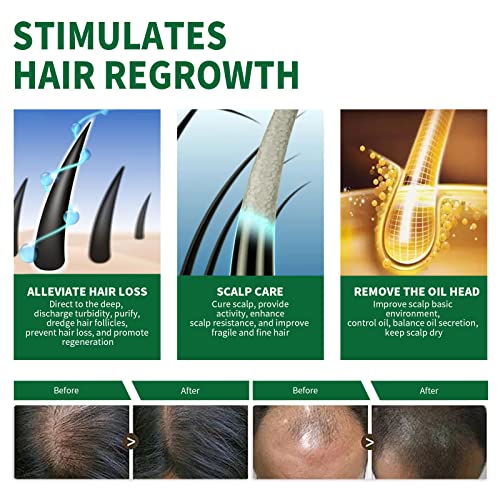 Tratamento de crescimento de cabelo Rebropador de bicos estendidos Rebropam cabelos mais espessos, ajuda a revitalizar os folículos