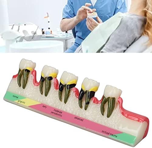 DentalPathologicalModel, Inglês Palavras Educacionais de TeethiseEseasEmodel ClearStructure for DentalHospitals