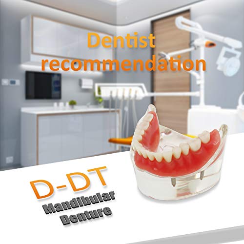 Modelo de dentes dentários, maxilar Mandibulartransparent Dental Implant Model Dentista Dentista Doença Removível Modelo de