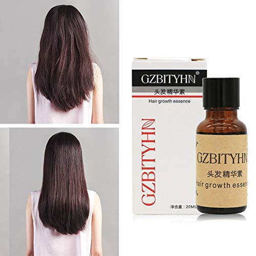 Soro de crescimento de cabelo gengibre, 20 ml de tratamento de regenharia de cabelo, soro de cabelo, óleo de crescimento de cabelo, essência do crescimento do cabelo, tratamentos para perda de cabelo, prevenção de queda de cabelo, cabelos prejudicados para mulheres homens