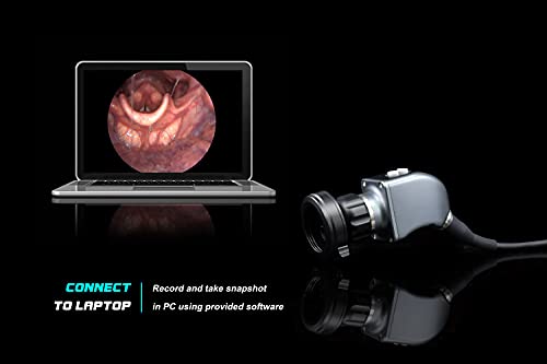 Câmera de endoscopia de Medicams ESC HDR 1.2MP ENT rígido com acoplador Adaptador 720p HD