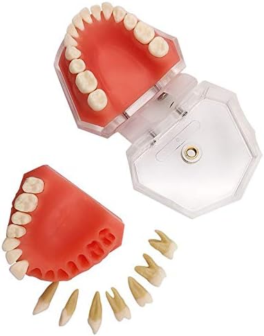 Modelo de dentes de implante dental do implante dental KH66ZKY - Modelo de cuidados dentários - dentes dentários Modelo