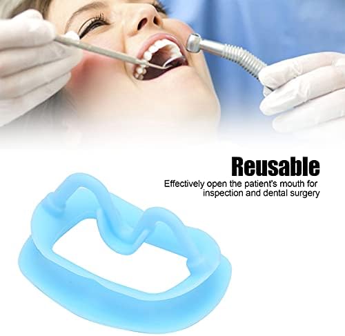 Retutor de bochecha de silicone, abridor de bocal de inspeção oral e ecológica segura para clínica odontológica para o hospital