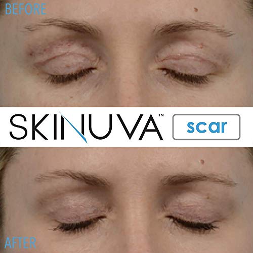 Skinuva® Próxima geração Creme de cicatriz + Skinuva® Brite Hyperpigmentation Treatment | Remoção de cicatriz avançada