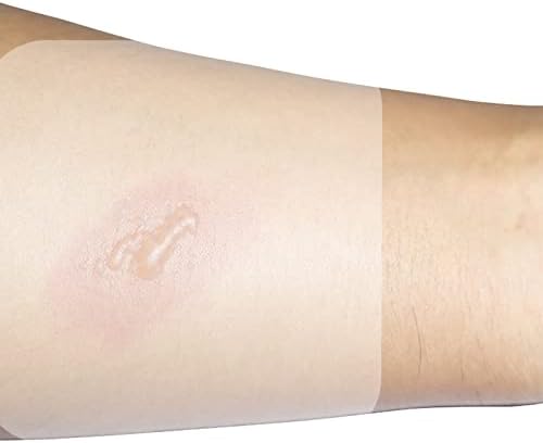 Fita de cicatriz 2pcs hidrocolóides patches adesivos estéreis bandagens hidrocolóides curar fita à prova de água
