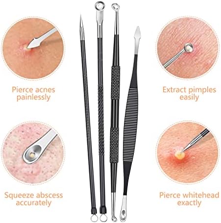 Kit de ferramentas Pimple Popper, ferramentas de removedor de cravos ikoco, incluindo extratores de comedona de 8pcs e espelho