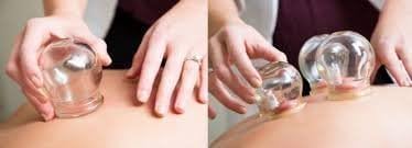 Terapia de massagem chinesa. Conjunto de 5 xícaras de massagem de vidro. Jarros de cupping, URSS pela URSS