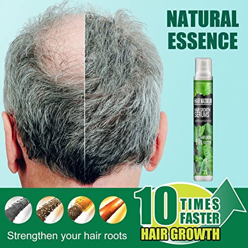 Spray de cabelo, spray de essência de crescimento de cabelo de ervas para prevenir o pós-parto queda de cabelo hamboilas de ervas essência spray 10ml