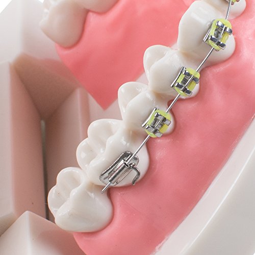 Denshine Dental Teach Study Demonstração de adultos Modelo de dentes com colchetes