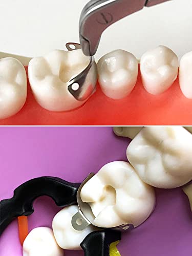 Bandas de matriz dentária, sistema de matrizes de metais com contornos seccionais para Matrizes Metal para Dentista de