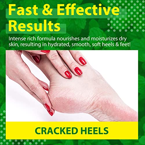 NBC Beautilab Repare Creme de pé, loção para os pés para pés rachados seco, tratamento de salto rachado hidratante creme de