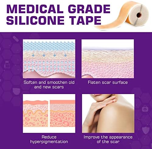Kelinul Silicone Scarets Remoção de cicatriz Fita de cicatriz de silicone para amaciar e achatar cicatrizes, acne, cesariana, cirurgia