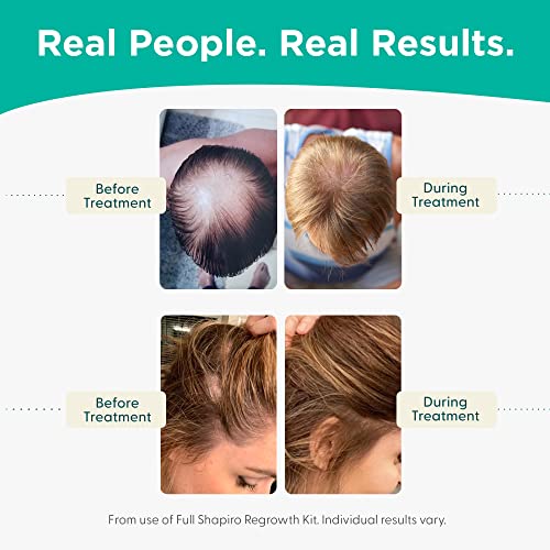 Espuma diária para perda de cabelo | DHT Formula vegana de combate a um cabelo de afinação desenvolvido por dermatologistas | Experimente