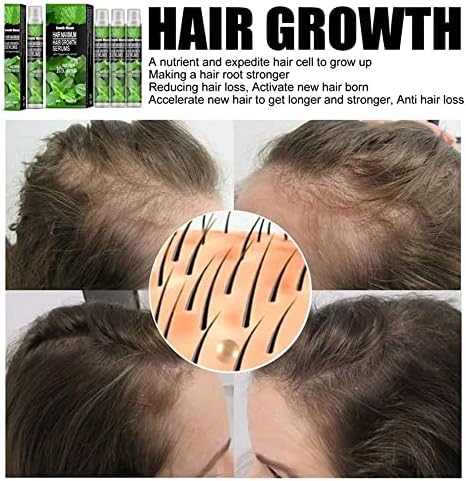 Spray de crescimento de cabelo de hortelã Spray rápido Cabelo anti -perda de cabelo Produtos Líquido para nutrição Cabelo Evite o cabelo de cabelo seco