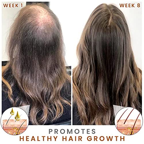 Óleo de essência do crescimento do cabelo PURC, óleo essencial de densidade de cabelo natural puro, impede tratamentos de couro cabeludo que crescem produtos capilares em rápido crescimento para homens mulheres