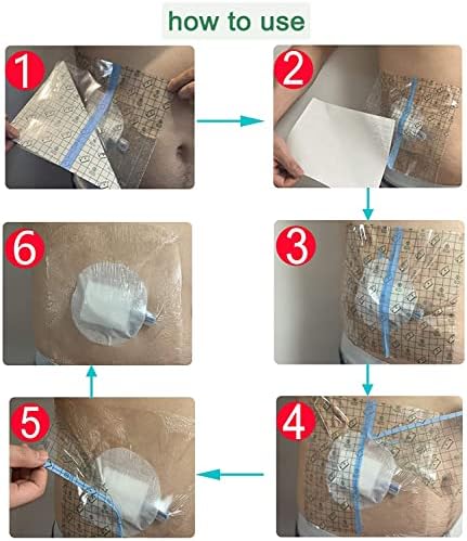 Bandagens à prova d'água Muyu escudo de chuveiro, tampa de vedação de feridas para manter a ostomia, porta de diálise, linha de