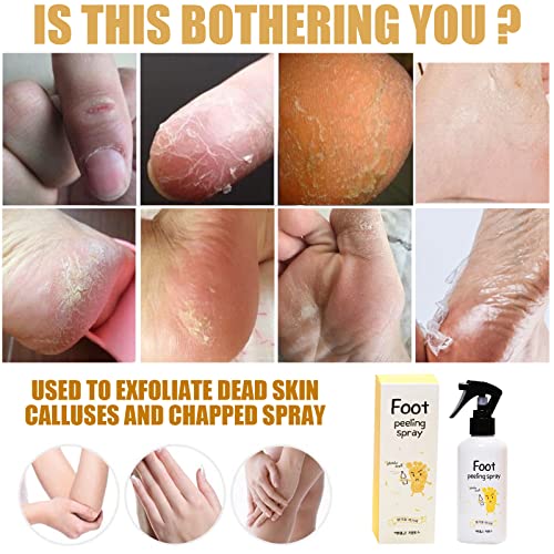 Spray de atendimento a pé Desquamação de calor de alívio do pé Spray de pé de rachadura de pele, adequado para cuidados