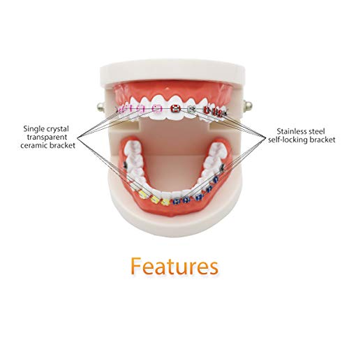 Modelo de dentes dentários D-Or, dentes dentários transparentes Modelo de dentes do dentista Padrão de doença removível Modelo