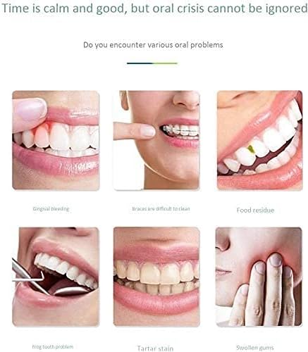 Fluxo dental sem fio SMSOM, Irrigador oral dental portátil, limpador de dentes recarregáveis, Ipx7 à prova d'água, tanque