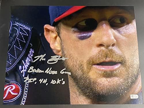 Max Scherzer Broken nariz jogo 7IP, 4H, 10 Ks assinado 11x14 foto mlb holo - fotos autografadas da MLB