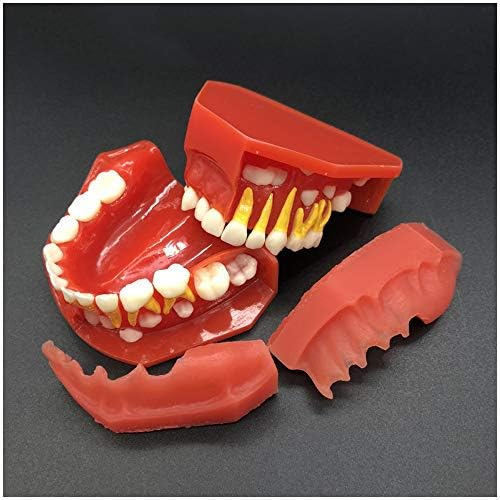 Modelo de dentes infantis KH66ZKY - Modelo de dentes primários alternados - 3-6 anos de idade de dentes primários e permanentes de dentes alimentares de desenvolvimento alternativo