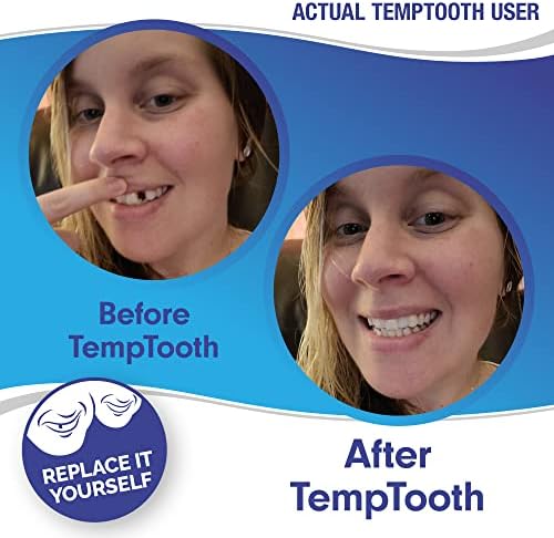 Kit de reposição de dentes temporários, enchimento de bricolage para falta de dente