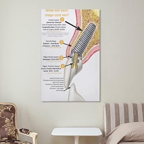 Posters Implante odontológico Poster odontológico Poster Dental Poster Medical Poster de lona Arte de parede Impressões