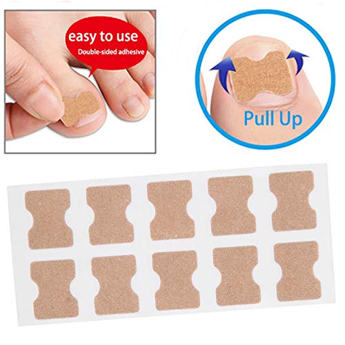 9PCs / Set Firwn Pound Correction Tool, adesivos de correção da unha encravada, ferramenta de planejamento de adesivos encravados da unha, inclua arquivo de unha encravada e levantador de unhas dos pés