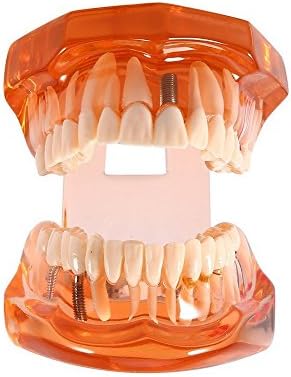Dr. Modelo de dentes brancos Modelo de laranja, transparente de doenças de doenças modelo Ferramentas de ensino de dentes removíveis padrão para aluno